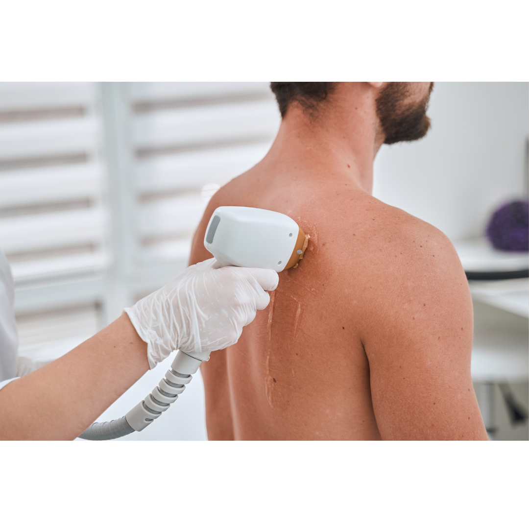 depilación láser unisex en madrid